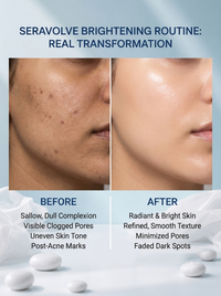 Seravolve Skin Brightening Routine (3-Step Kit)