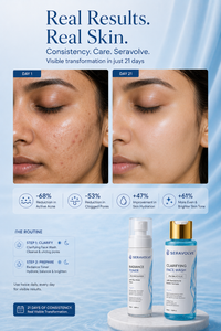Seravolve Smooth Skin Routine (2-Step Kit)