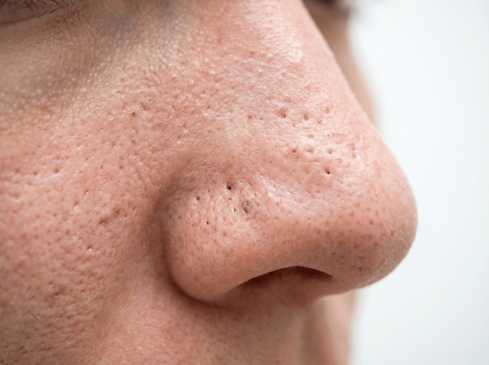 Pores & Texture